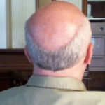 old man with a bald head